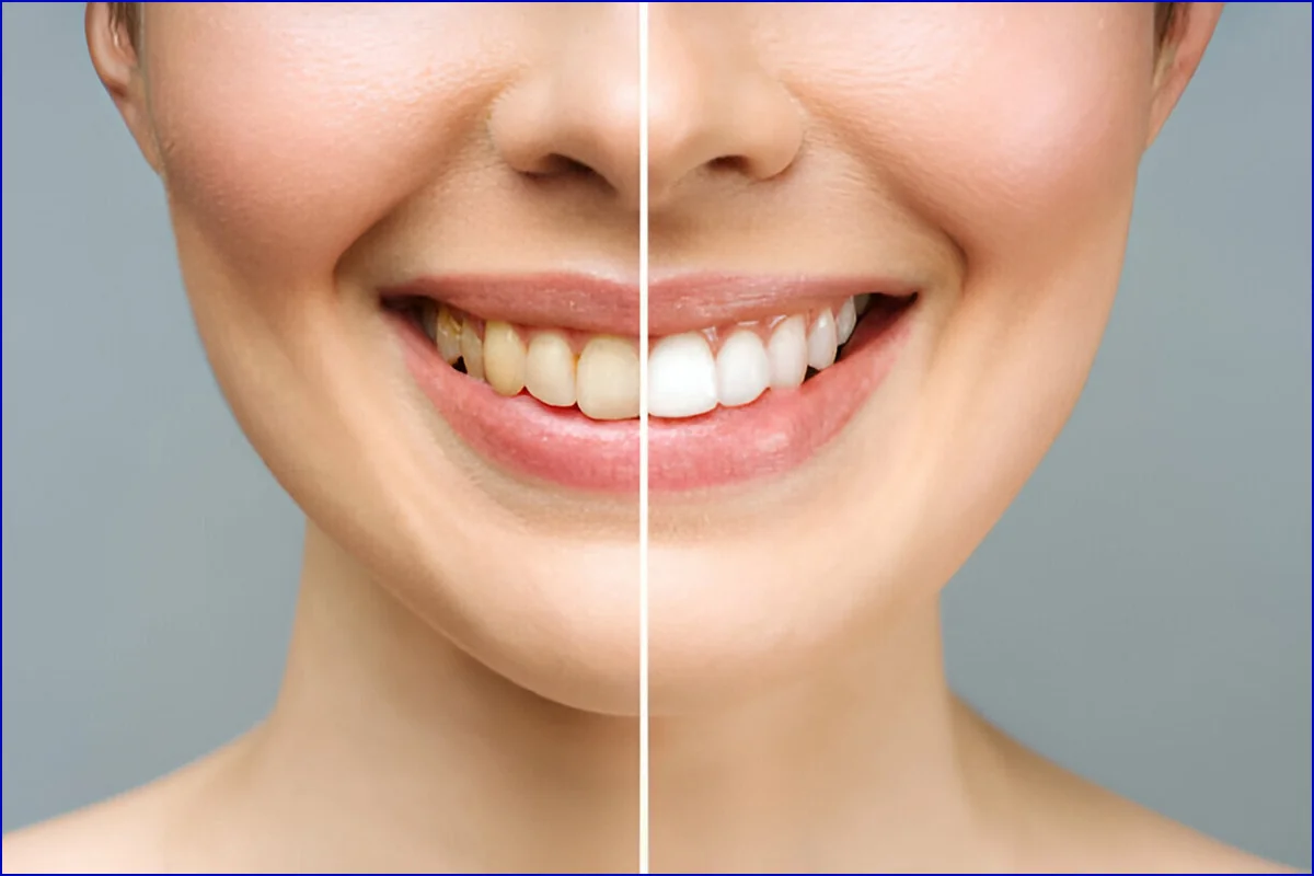 Cosmetic Treatment treatment photo 2