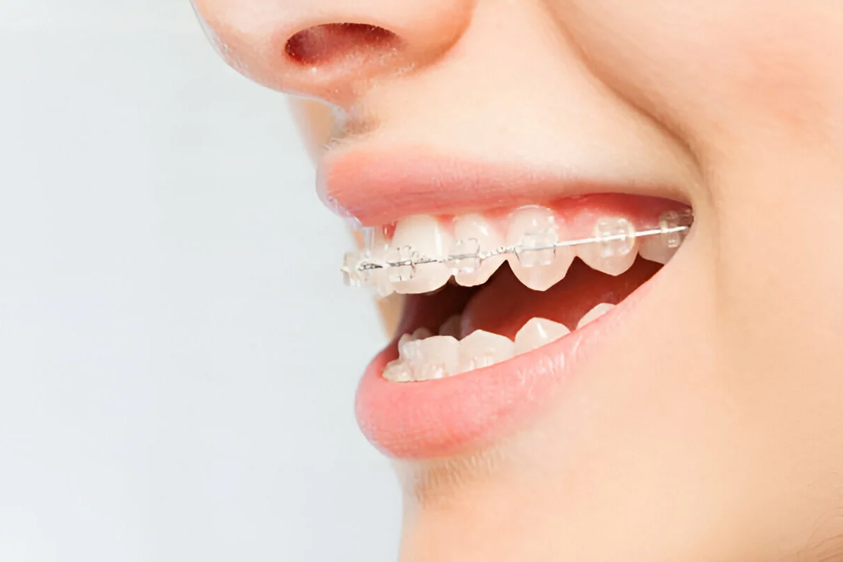 Orthodontics & Invisalign treatment photo 3