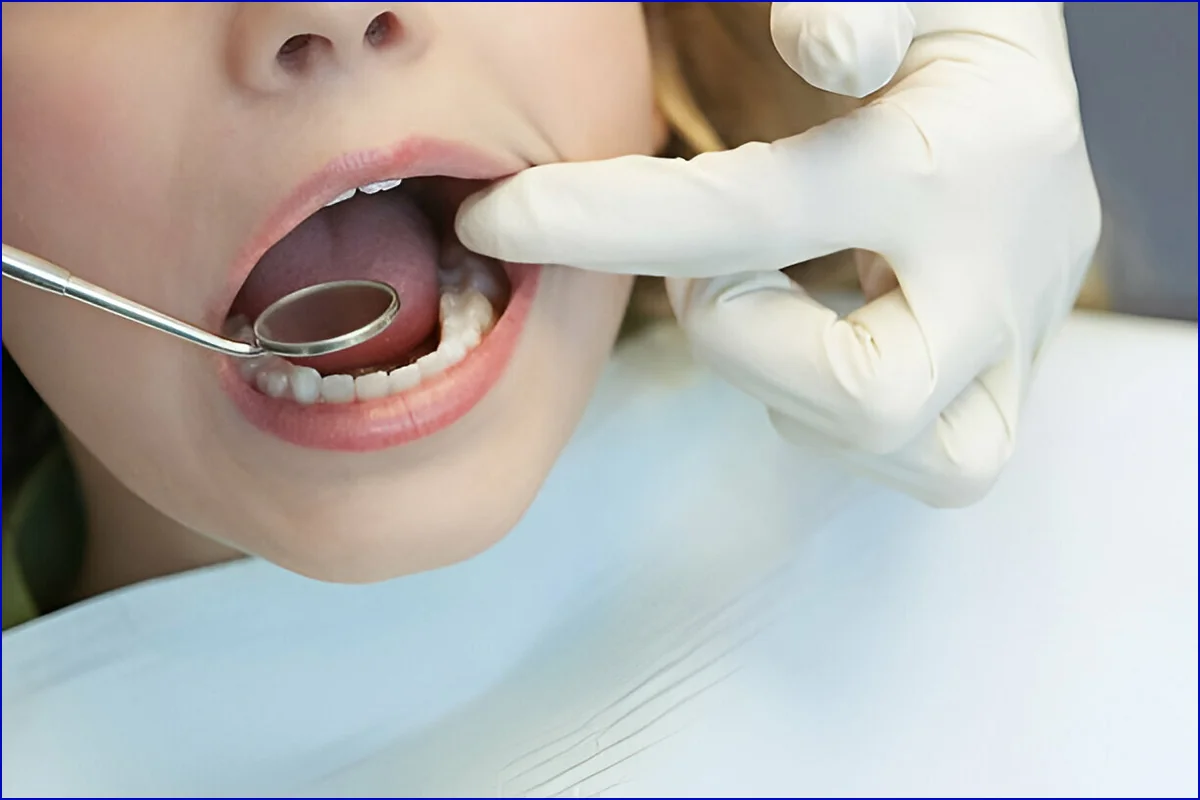 Paediatric Dentistry treatment photo 2