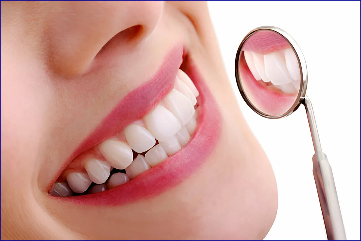 Smile Designing treatment photo 2