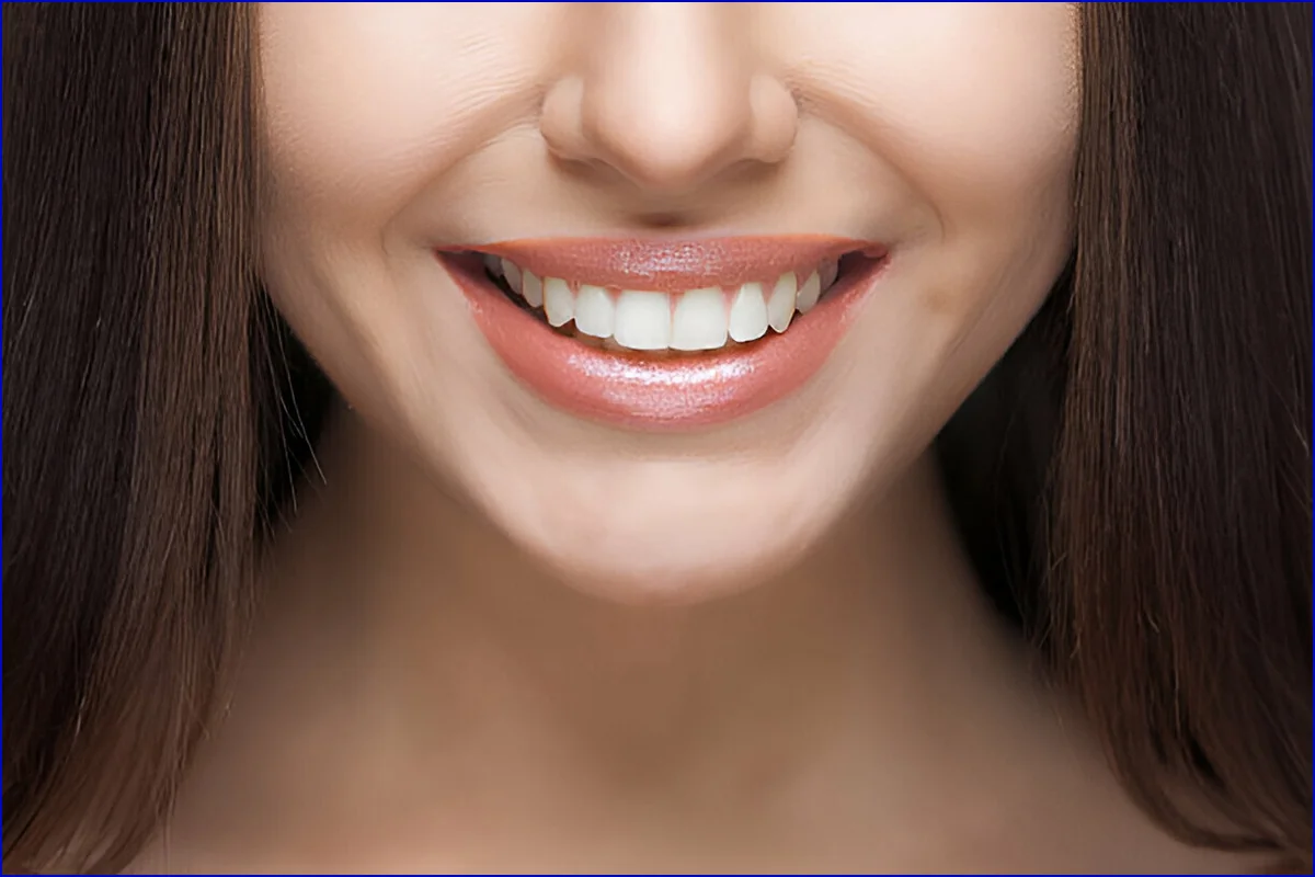 Smile Designing treatment visual