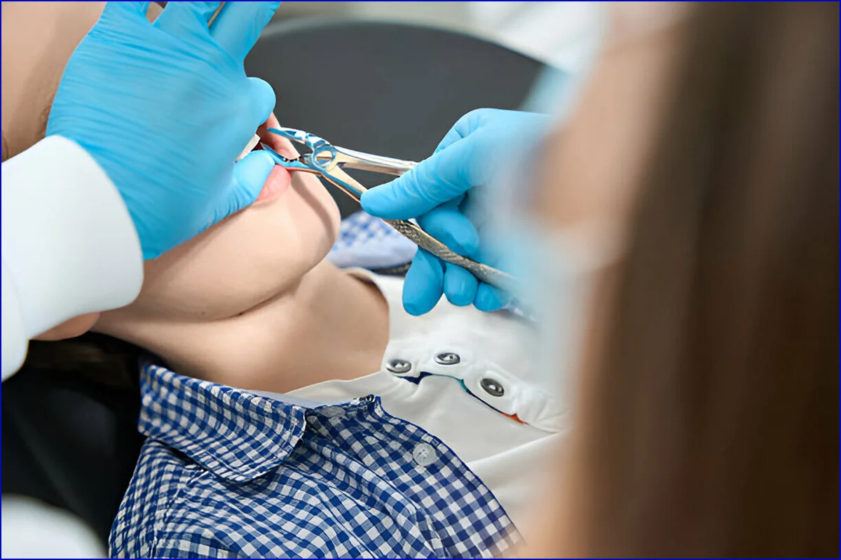 Extraction treatment photo 3
